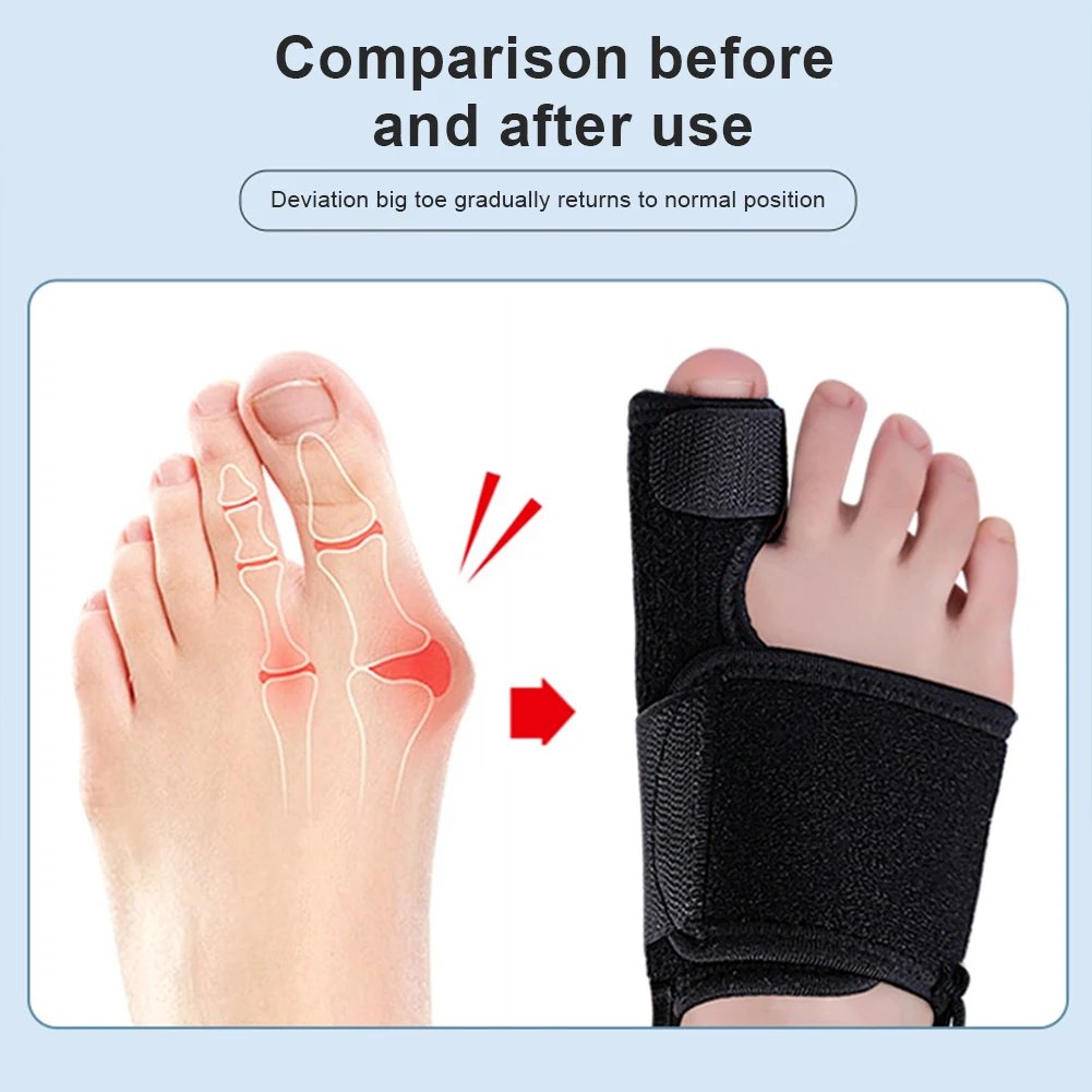 Toe Corrector Orthotics Bone Thumb Adjuster Hammer Protector Hallux Valgus Corrector Bunion Corrector Orthopedic Tool Care Tools